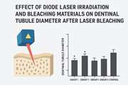 Evaluation of the Diode laser (810nm,980nm) on dentin tubule diameter following internal bleaching